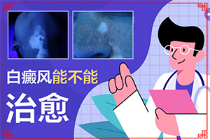 電焊烤的額頭有白斑塊怎么會事，有處理辦法嗎，（需要怎么治療）