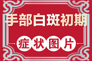 小孩微量元素缺乏臉上會有白斑,白斑的因由是哪些(哪些誘因會導致白癜風)