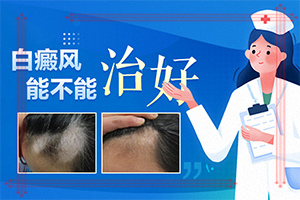 兒童白顛瘋病可以嗎[要怎么治療]白殿瘋吃什么藥能