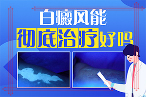 嘴角有一塊白斑一年了還沒好怎么辦（需要什么樣的治療）