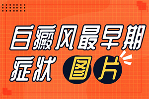 [嚴重還能治好嗎小孩子白點癲風能治療好嗎