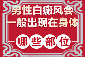 白癲風(fēng)的癥狀是什么,特征是怎么樣的(如何正確區(qū)分)