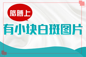 白點癲風怎樣治[如何調節(jié)控制]治療兒童白斑需要多少錢