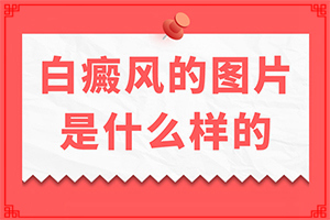 孩子背后長白斑怎么辦,不同時(shí)期的病發(fā)表現(xiàn)是怎樣的(要做什么檢查)