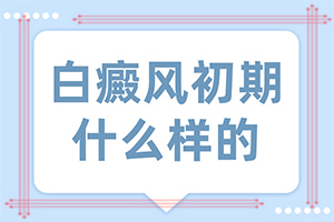 為什么會白殿風(fēng)-曬了一個(gè)月臉上有白斑怎么回事