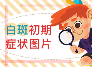 鼻子出現(xiàn)小白斑-癥狀有哪些方面的表現(xiàn)