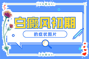 輕微白癩風(fēng)圖片,又有哪些癥狀表現(xiàn)呢(如何區(qū)分)