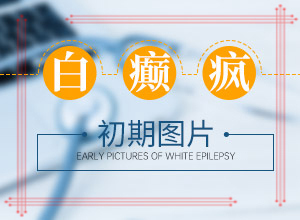 為什么會(huì)長(zhǎng)白班-出現(xiàn)的原因是什么