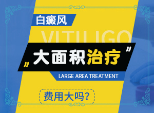 哪個(gè)醫(yī)院治療白癜風(fēng)好,為何不易治(診治白斑什么好)