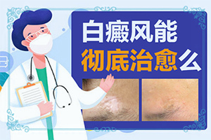 皮膚白斑-普通白斑的圖片-診斷步驟是什么