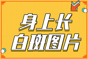 白瘋顛的原因是什么-5個(gè)月寶寶胸前有白斑怎么回事