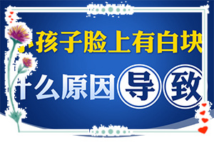 白癩風(fēng)是不是治不好-[教你判斷]怎樣控制白斑不擴(kuò)散