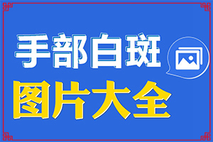 百癲瘋可以嗎,能盡快治療好嗎(白斑病總是治不好呢)