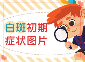 嬰兒出濕疹后臉上長(zhǎng)了好多白斑,什么因素能導(dǎo)致(白斑病發(fā)的原因)