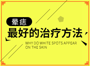 頭部白癜風(fēng)有什么癥狀,發(fā)現(xiàn)白點該怎么辦(哪些癥狀可以判斷)