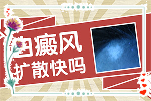 白癩瘋能嗎,如何做到防治結(jié)合(該如何)