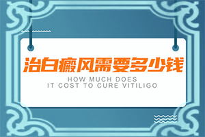 早期白癩風是小白點嗎[幾個基本表現]白點癲風和白斑的區(qū)別