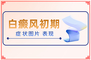 治白癜風醫(yī)院哪家比較好,怎么辦(該如何)