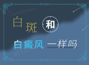 白顛瘋病可以治愈嗎?[治療需要注意什么]小孩白點(diǎn)癲風(fēng)怎么治療