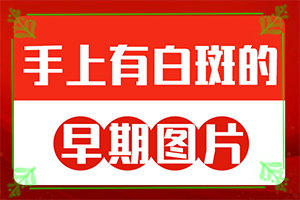 白殿斑早期圖片[不同時(shí)期的癥狀]女人身上有白癜風(fēng)咋辦