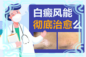 白瘋癲是怎么產生的-嬰幼兒胳膊上有白斑怎么回事。