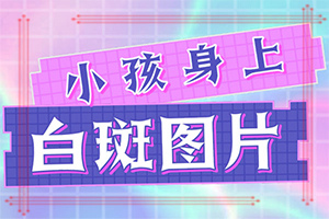 白癜風(fēng)初期是什么樣的,癥狀有哪些方面的表現(xiàn)(發(fā)生后是什么樣子的)