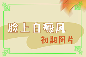 長(zhǎng)白班是什么原因-四歲小孩臉上有白斑是什么原因