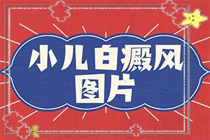 白巔風(fēng)的癥狀[癥狀如何診斷]胳膊起白班怎么回事