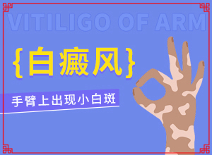 眼皮上長了一小塊白斑-主要癥狀是什么