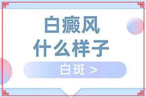 白癩風(fēng)前期癥狀是什么,具體表現(xiàn)是哪些(如何知道白斑是否為白癜風(fēng))