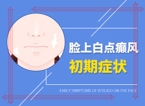 面上長白班什么原因,發(fā)病的時候有什么癥狀(應(yīng)該怎么護(hù)理)