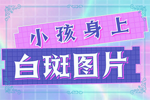 白點(diǎn)癲風(fēng)治療費(fèi)用[嚴(yán)重還能治好嗎]只有手上長(zhǎng)白巔峰怎么治