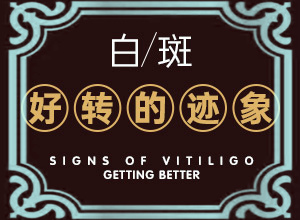 [可以治好嗎白癲瘋手上能治療好嗎