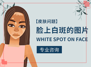 太陽爆曬后出現(xiàn)的白斑能治愈嗎,發(fā)病的因素是(為什么患上)