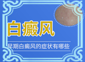 2歲寶寶臉上有白斑，膚色不均勻涂什么藥（為什么會好治）