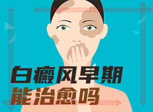 白癜風(fēng)遺傳的幾率大不大-曬了一個(gè)月臉上有白斑怎么回事