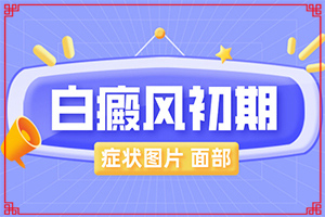 兒童白點癲風(fēng)可以治愈嗎-怎樣控制白斑不擴散