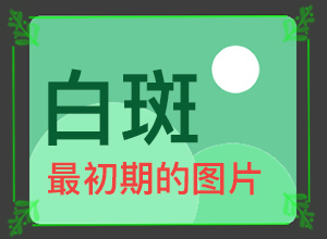 臉上好端端的長(zhǎng)了白斑,會(huì)有什癥狀(幾個(gè)基本表現(xiàn))