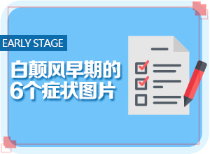 嬰幼兒胳膊上長白斑是什么原因,白斑誘發(fā)什么有關(什么原因會誘導白斑)