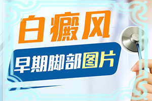 嘴皮長(zhǎng)白斑是怎么回事,早期診斷方法(區(qū)別怎樣區(qū)別辨識(shí))