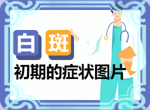 小面積的白癜風(fēng)好治嗎[典型表現(xiàn)]皮膚上長白班什么原因