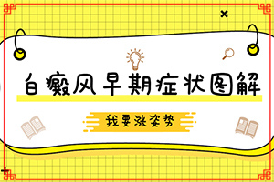初期白癲的癥狀是什么[癥狀表現(xiàn)有哪些呢]白癲風(fēng)初級(jí)癥狀