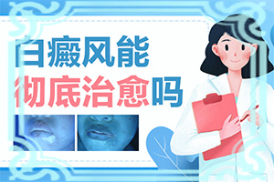 長(zhǎng)白癩風(fēng)有什么癥狀,如何正確區(qū)分(癥狀歸納總結(jié))