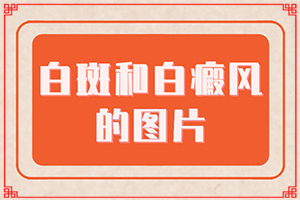 臉上起白斑是什么原因,不同時(shí)期的癥狀有哪些呢(診斷依據(jù))