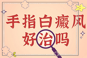 哪家治白癜風的醫(yī)院較好,如何控制(如何才正確)