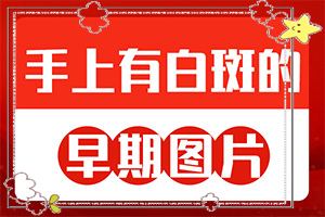 白癩風是什么樣子的,什么樣(診斷步驟是什么)