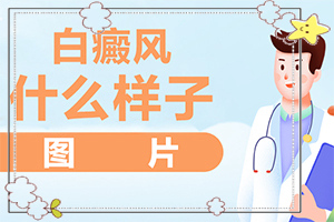 白癩風(fēng)的圖片早期,初期癥狀有哪些(得了會(huì)有什么特征)