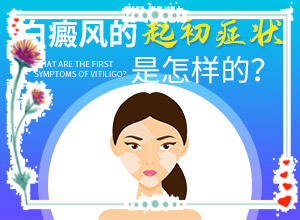 為什么手臂上會(huì)有小白斑[癥狀歸納總結(jié)]白點(diǎn)癲風(fēng)是什么樣的