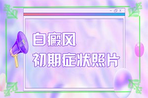 三個(gè)月嬰兒脖子上有白斑是怎么回事怎么治（用什么治）