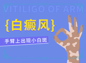 四歲小孩下面長白班,什么樣(跟其他皮膚病的區(qū)別在哪呢)